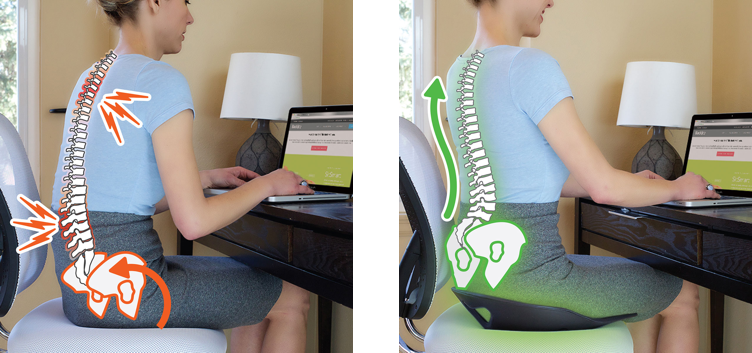 BackJoy SitSmart Posture Core
