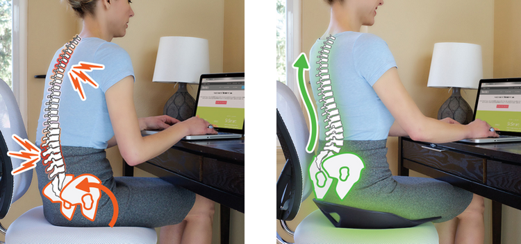 BackJoy SitSmart Posture Core Traction